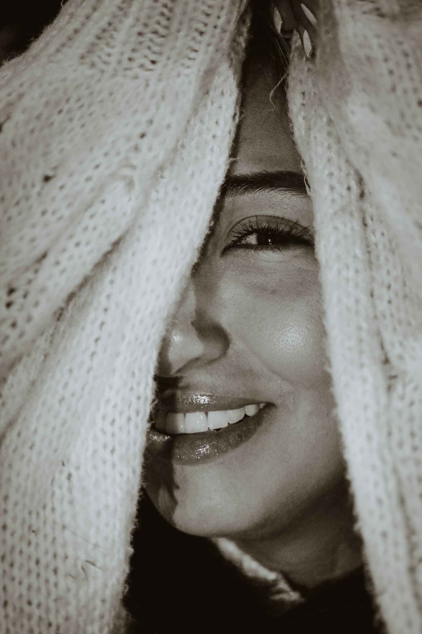 Sonrisa blanca después del blanqueamiento