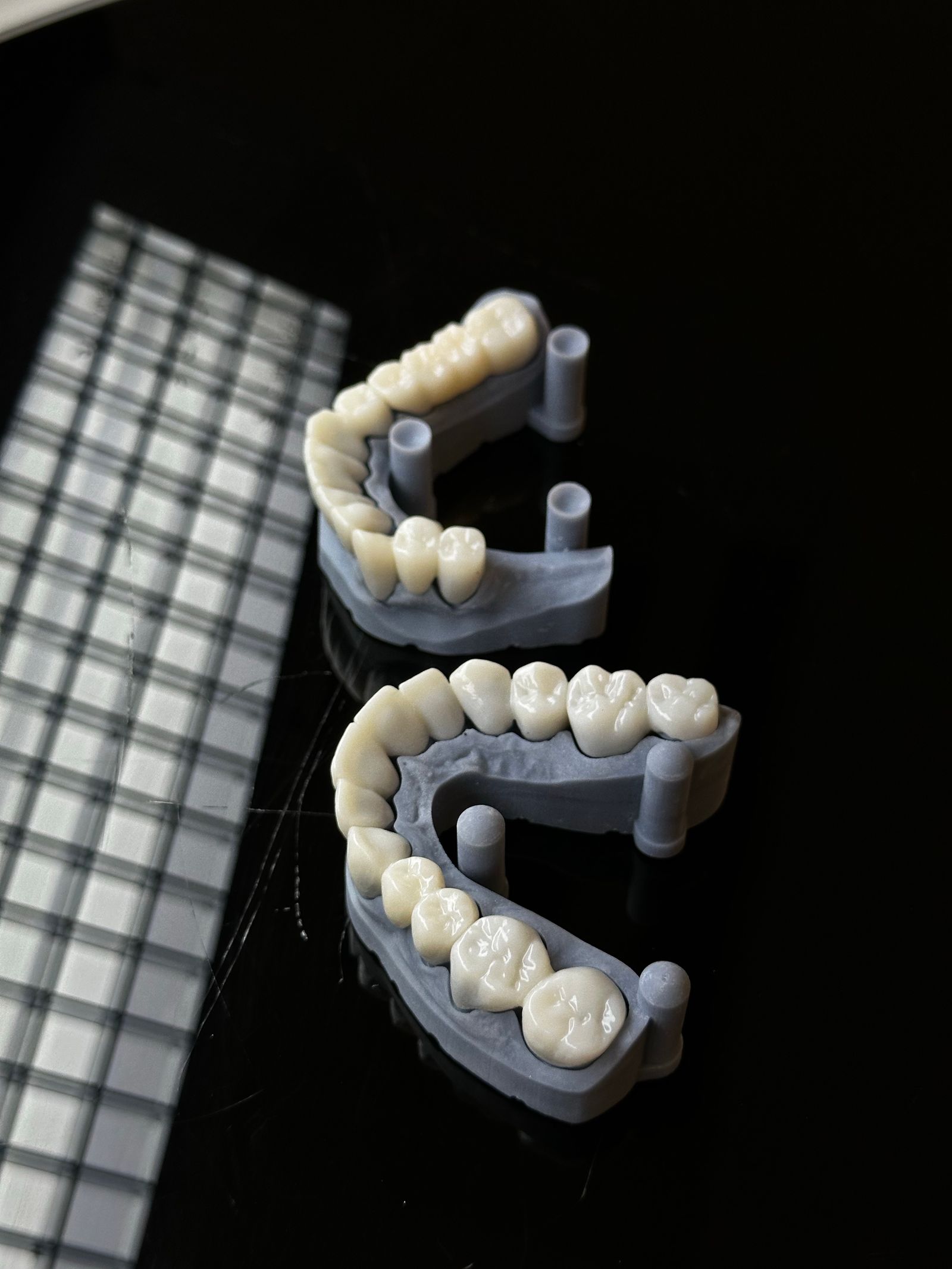 Modelos dentales impresos en 3D