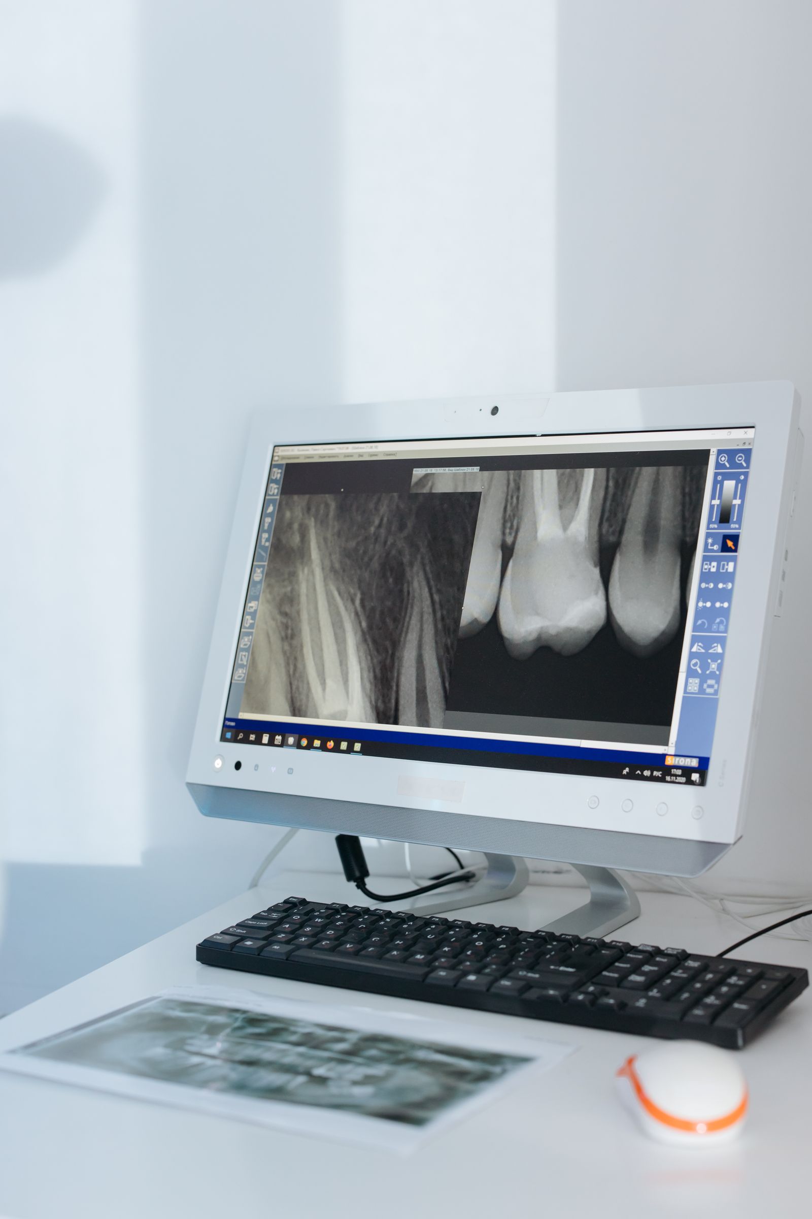 Radiografía dental en monitor de diagnóstico